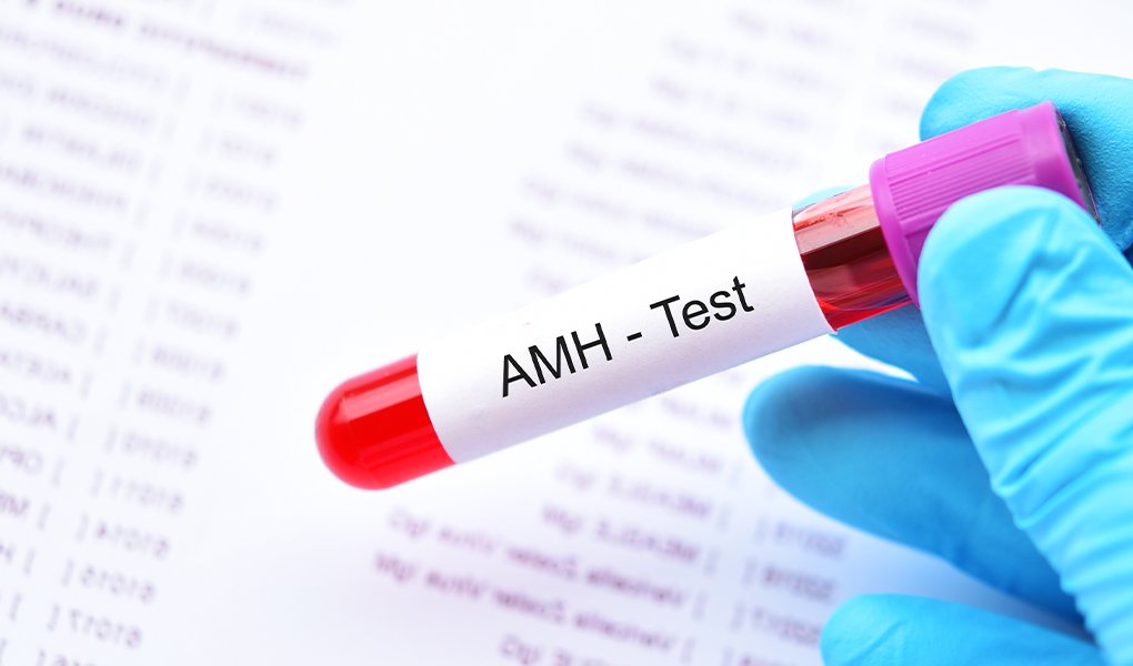 Egg Count and Fertility Test (AMH-Anti Mullerian Hormone Test)