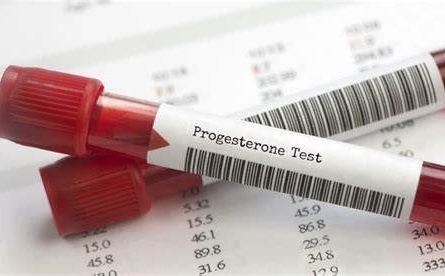 Ovulation Blood Test (Day 21 Progesterone Test)